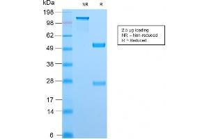 SDS-PAGE Analysis Purified Topo I Rabbit Recombinant Monoclonal Antibody (TOP1MT/2883R). (Recombinant TOP1MT 抗体)