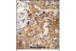 NDST1 Antibody (C-term) (ABIN657148 and ABIN2846284) immunohistochemistry analysis in formalin fixed and paraffin embedded human liver tissue followed by peroxidase conjugation of the secondary antibody and DAB staining. (NDST1 抗体  (C-Term))