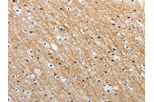 The image on the left is immunohistochemistry of paraffin-embedded Human brain tissue using ABIN7189659(ADAMTS19 Antibody) at dilution 1/25, on the right is treated with synthetic peptide. (ADAMTS19 抗体)