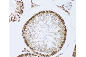Immunohistochemistry of paraffin-embedded Mouse testis using CIRBP Polyclonal Antibody at dilution of 1:100 (20x lens). (CIRBP 抗体)