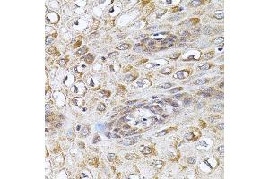 Immunohistochemistry of paraffin-embedded human esophagus using CETP antibody.