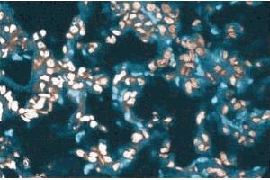 Immunohistochemical staining of a rabbit lung section. (SMARCA2 抗体  (AA 1400-1586))