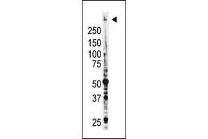 Image no. 2 for anti-Myeloid/lymphoid Or Mixed-Lineage Leukemia (MLL) (C-Term) antibody (ABIN356674) (MLL/KMT2A 抗体  (C-Term))