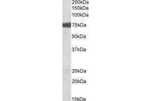 Western Blotting (WB) image for anti-Ribosomal Protein S6 Kinase, 90kDa, Polypeptide 2 (RPS6KA2) (C-Term) antibody (ABIN2464829) (RPS6KA2 抗体  (C-Term))
