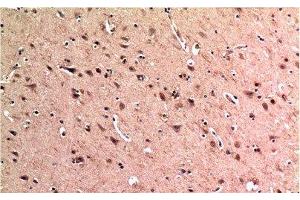 Immunohistochemistry of paraffin-embedded Human brain tissue using BECN1 Monoclonal Antibody at dilution of 1:200. (Beclin 1 抗体)