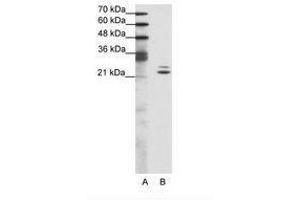 Image no. 1 for anti-BUD31 Homolog (BUD31) (AA 71-120) antibody (ABIN202030) (BUD31 抗体  (AA 71-120))