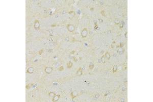 Immunohistochemistry of paraffin-embedded rat brain using TRAP1 Antibody (ABIN1875197) at dilution of 1:100 (40x lens). (TRAP1 抗体)