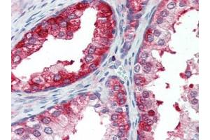 Human Prostate (formalin-fixed, paraffin-embedded) stained with SKP2at 10 µg/ml followed by biotinylated goat anti-rabbit IgG secondary antibody, alkaline phosphatase-streptavidin and chromogen. (SKP2 抗体  (AA 221-425))