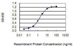 Detection limit for recombinant GST tagged DCLK3 is 0. (DCLK3 抗体  (AA 175-284))