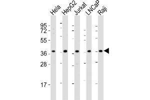 All lanes : Anti-DFFB Antibody (N-term) at 1:2000 dilution Lane 1: Hela whole cell lysates Lane 2: HepG2 whole cell lysates Lane 3: Jurkat whole cell lysates Lane 4: LNCaP whole cell lysates Lane 5: Raji whole cell lysates Lysates/proteins at 20 μg per lane. (DFFB 抗体  (N-Term))