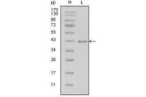 Western blot analysis using LAMB1 mouse mAb against truncated LAMB1-His recombinant protein (1). (Laminin beta 1 抗体  (AA 31-270))