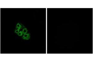 Immunofluorescence analysis of A549 cells, using LSHR Antibody. (LHCGR 抗体  (AA 621-670))
