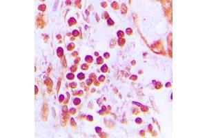 Immunohistochemistry (IHC) image for anti-Cleavage Stimulation Factor, 3' Pre-RNA, Subunit 1, 50kDa (CSTF1) (N-Term) antibody (ABIN7299198)