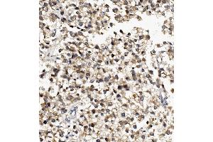 IHC analysis of DNAJA2 using anti-DNAJA2 antibody (ABIN7598991).
