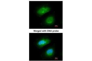 ICC/IF Image Immunofluorescence analysis of paraformaldehyde-fixed HeLa, using PRAK, antibody at 1:200 dilution. (MAPKAP Kinase 5 抗体)