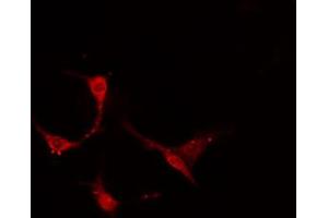 ABIN6274159 staining A549 cells by IF/ICC. (TACSTD2 抗体  (Internal Region))