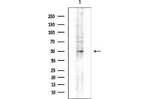 anti-UDP Glucuronosyltransferase 2 Family, Polypeptide B7 (UGT2B7) (Internal Region) antibody