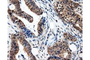 Immunohistochemistry (IHC) image for anti-Proteasome (Prosome, Macropain) 26S Subunit, ATPase, 3 (PSMC3) antibody (ABIN1501331) (PSMC3 抗体)