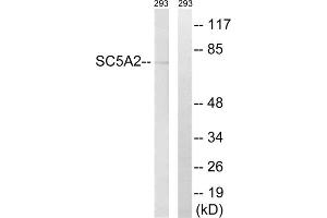 Western blot analysis of extracts from 293 cells, using SLC5A2 antibody. (SLC5A2 抗体  (Internal Region))