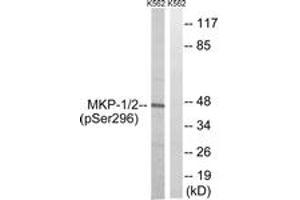 Western blot analysis of extracts from K562 cells treated with heat shock , using MKP-1/2 (Phospho-Ser296/318) Antibody. (MKP-1/2 抗体  (pSer296))