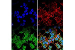 Immunocytochemistry (ICC) image for anti-Potassium Inwardly-Rectifying Channel, Subfamily J, Member 8 (KCNJ8) (AA 306-424) antibody (Atto 488) (ABIN6932453)