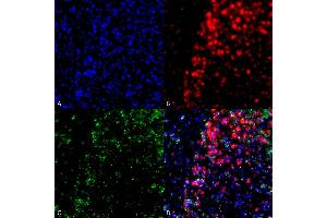 Immunocytochemistry/Immunofluorescence analysis using Mouse Anti-Alpha Synuclein Monoclonal Antibody, Clone 3F8 (ABIN5564089). (SNCA 抗体)