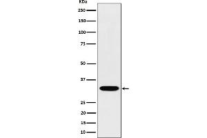 Western blot analysis of TSFM expression in Jurkat cell lysate. (Recombinant TSFM 抗体)