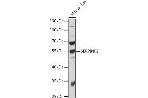 Western blot analysis of extracts of Mouse liver, using SERPINF2 antibody  at 1:1000 dilution. (alpha 2 Antiplasmin 抗体  (AA 302-491))