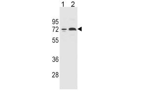 Western Blotting (WB) image for anti-Cytochrome P450, Family 2, Subfamily B, Polypeptide 6 (CYP2B6) antibody (ABIN2996016) (CYP2B6 抗体)