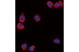 Immunofluorescent analysis of GPR87 staining in HuvEc cells. (GPR87 抗体)