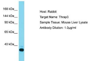Host: Rabbit Target Name: THRAP3 Sample Tissue: Mouse Liver Antibody Dilution: 1ug/ml (THRAP3 抗体  (N-Term))
