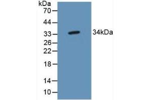 TP53TG5 抗体  (AA 190-262)