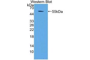 Western Blotting (WB) image for anti-Apoptosis Antagonizing Transcription Factor (AATF) (AA 240-438) antibody (ABIN2118159) (AATF 抗体  (AA 240-438))