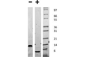 SDS-PAGE of Mouse Epidermal Growth Factor Recombinant Protein SDS-PAGE of Mouse Epidermal Growth Factor Recombinant Protein.
