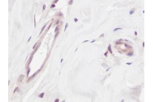 Image no. 1 for anti-Vascular Endothelial Growth Factor A (VEGFA) antibody (ABIN465403) (VEGFA 抗体)