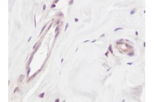 Image no. 1 for anti-Vascular Endothelial Growth Factor A (VEGFA) antibody (ABIN465403)