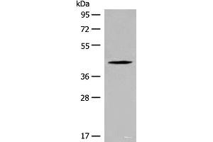 Western blot analysis of Jurkat cell lysate using QTRT1 Polyclonal Antibody at dilution of 1:450 (QTRT1 抗体)