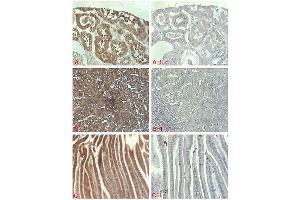 Immunohistochemical staining of of human tissue using anti-DLL1 (human), pAb  at 1:500 dilution. (DLL1 抗体)