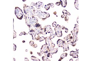 IHC analysis of CLPX using anti-CLPX antibody . (CLPX 抗体  (AA 337-574))