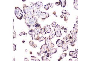 IHC analysis of CLPX using anti-CLPX antibody . (CLPX 抗体  (AA 337-574))