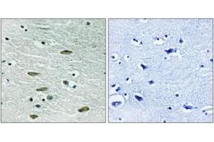 Immunohistochemistry analysis of paraffin-embedded human brain tissue, using IGF1R (Ab-1346) Antibody. (IGF1R 抗体  (AA 1311-1360))