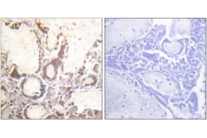 Immunohistochemistry analysis of paraffin-embedded human placenta, using GTPase Activating Protein (Phospho-Ser387) Antibody. (RACGAP1 抗体  (pSer387))