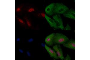 ABIN6257335 and ABIN6274168 staining  cells by IF/ICC. (MYF5 抗体  (N-Term))