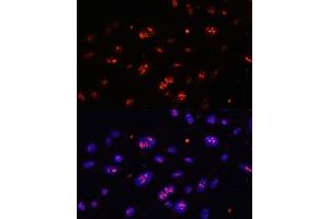 Immunofluorescence analysis of U-2 OS cells using DKC1 antibody (ABIN6127762, ABIN6139635, ABIN6139636 and ABIN6216722) at dilution of 1:100. (DKC1 抗体  (AA 1-180))