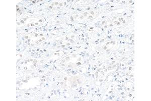 anti-ATP-Dependent RNA Helicase A (DHX9) (AA 200-250) antibody