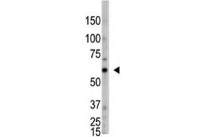 Western Blotting (WB) image for anti-2'-5'-Oligoadenylate Synthetase-Like (OASL) antibody (ABIN3002561) (OASL 抗体)