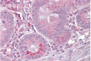 Immunohistochemistry with Small intestine tissue at an antibody concentration of 5µg/ml using anti-SLC13A2 antibody (ARP43864_P050) (SLC13A2 抗体  (Middle Region))