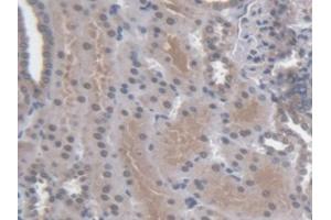 DAB staining on IHC-P; Samples: Human Kidney Tissue (Regucalcin 抗体  (AA 65-299))
