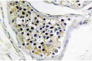 Immunohistochemistry (IHC) analyzes of CNOT4 antibody in paraffin-embedded human testis tissue. (CNOT4 抗体)