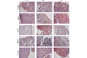 Immunohistochemistry (IHC) image for anti-Actin, alpha 2, Smooth Muscle, Aorta (ACTA2) (N-Term) antibody (ABIN2857027)